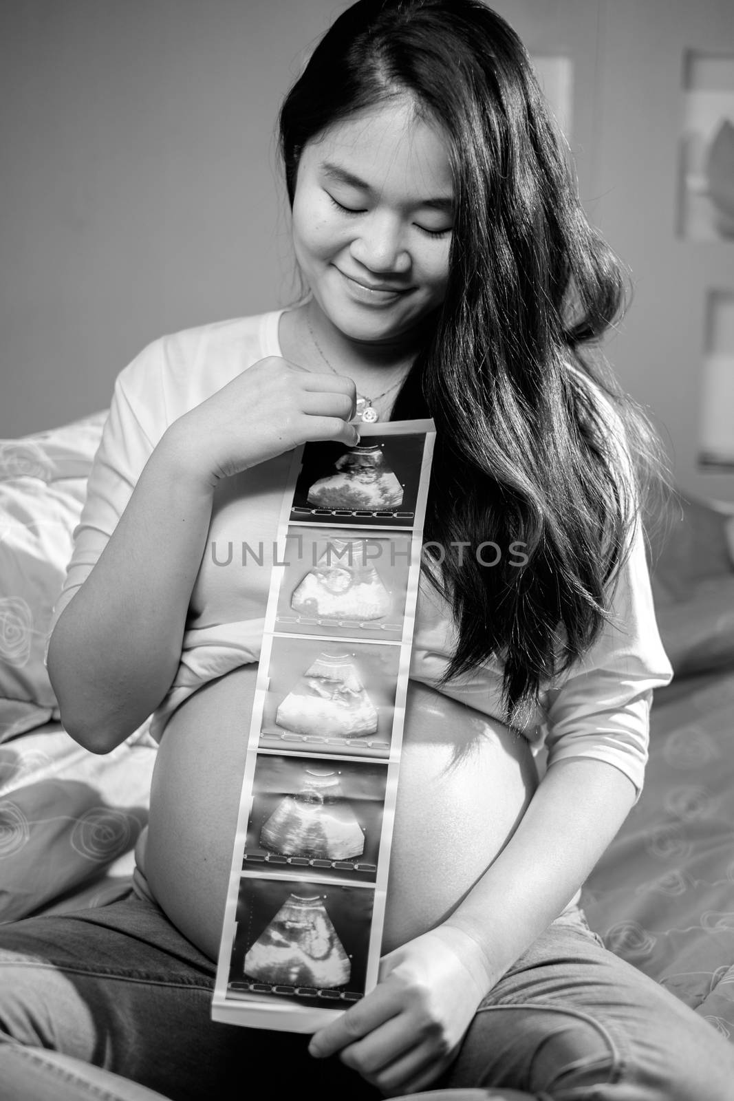 Asian pregnant women showing untrasond pictures