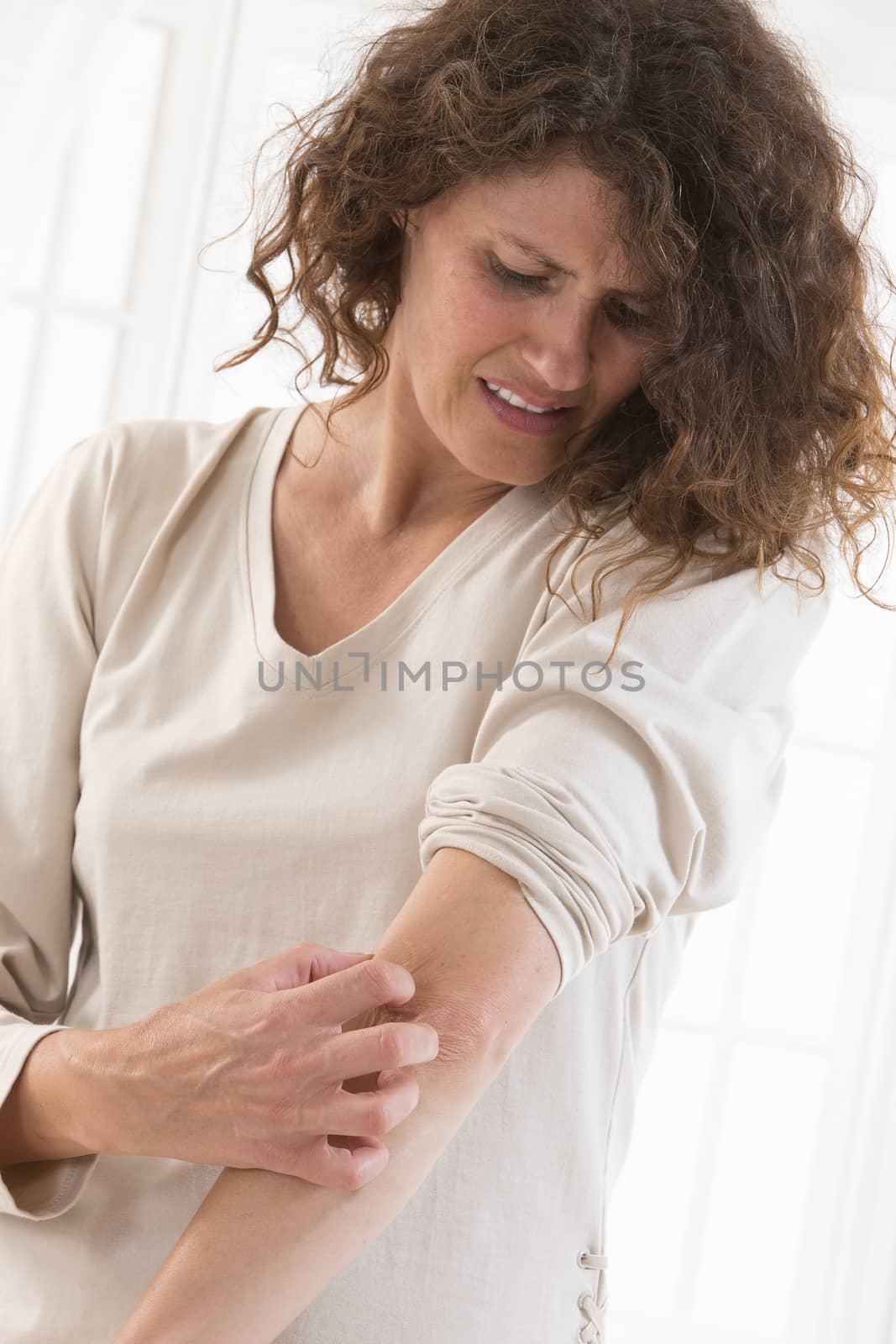 Woman suffering from  itching her arm