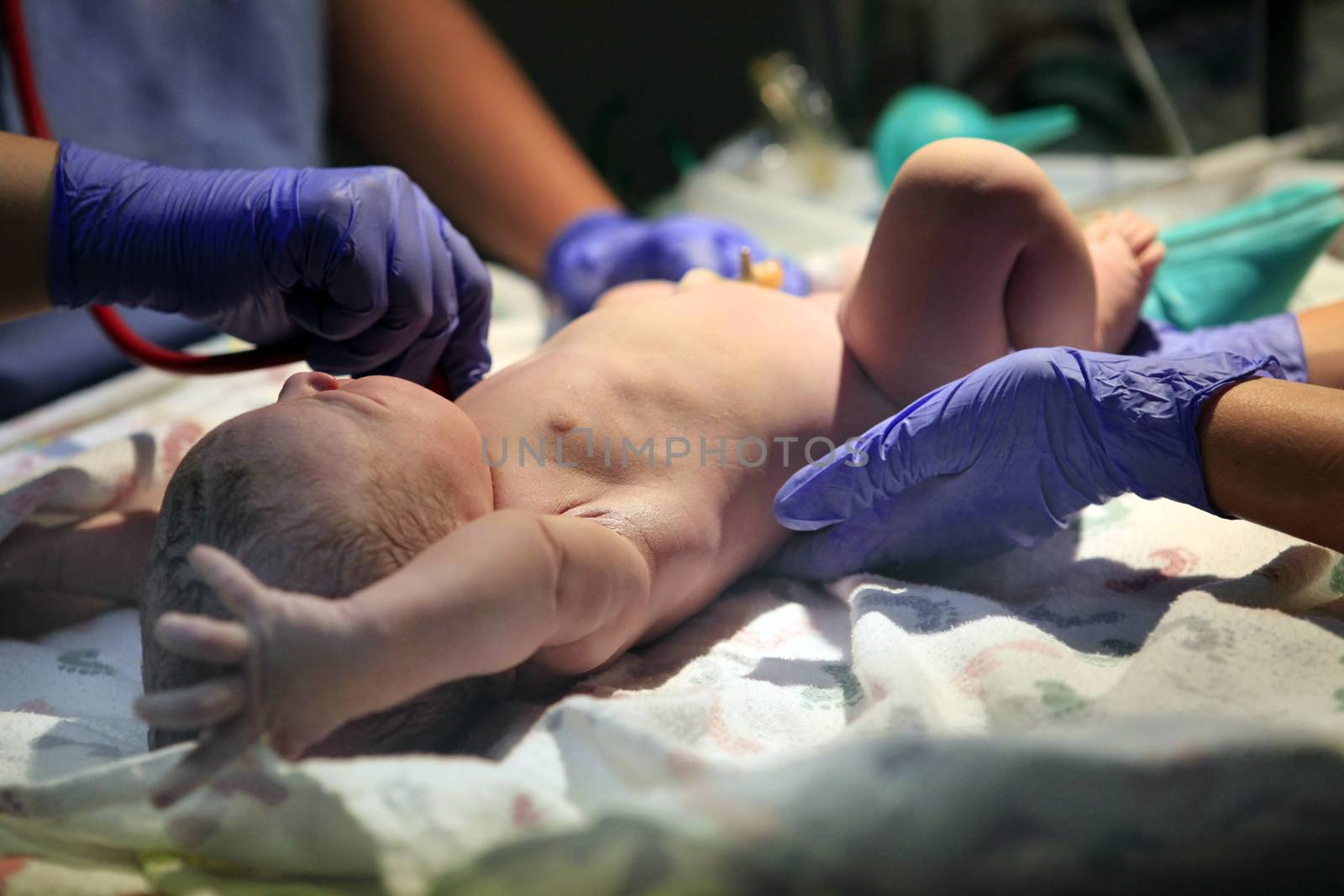 The first minutes of life of the newborn girl
