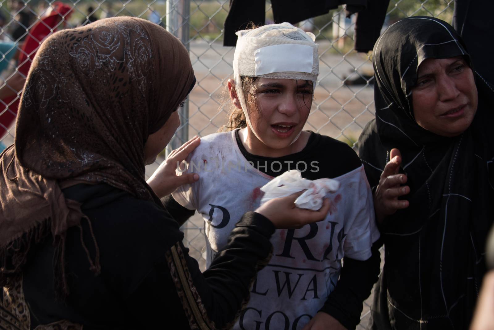 SERBIA, Horgos: Children are treated for injuries as Hungarian riot police clash with refugees waiting to cross the border from the Serbian border town of Horgos on September 16, 2015. 