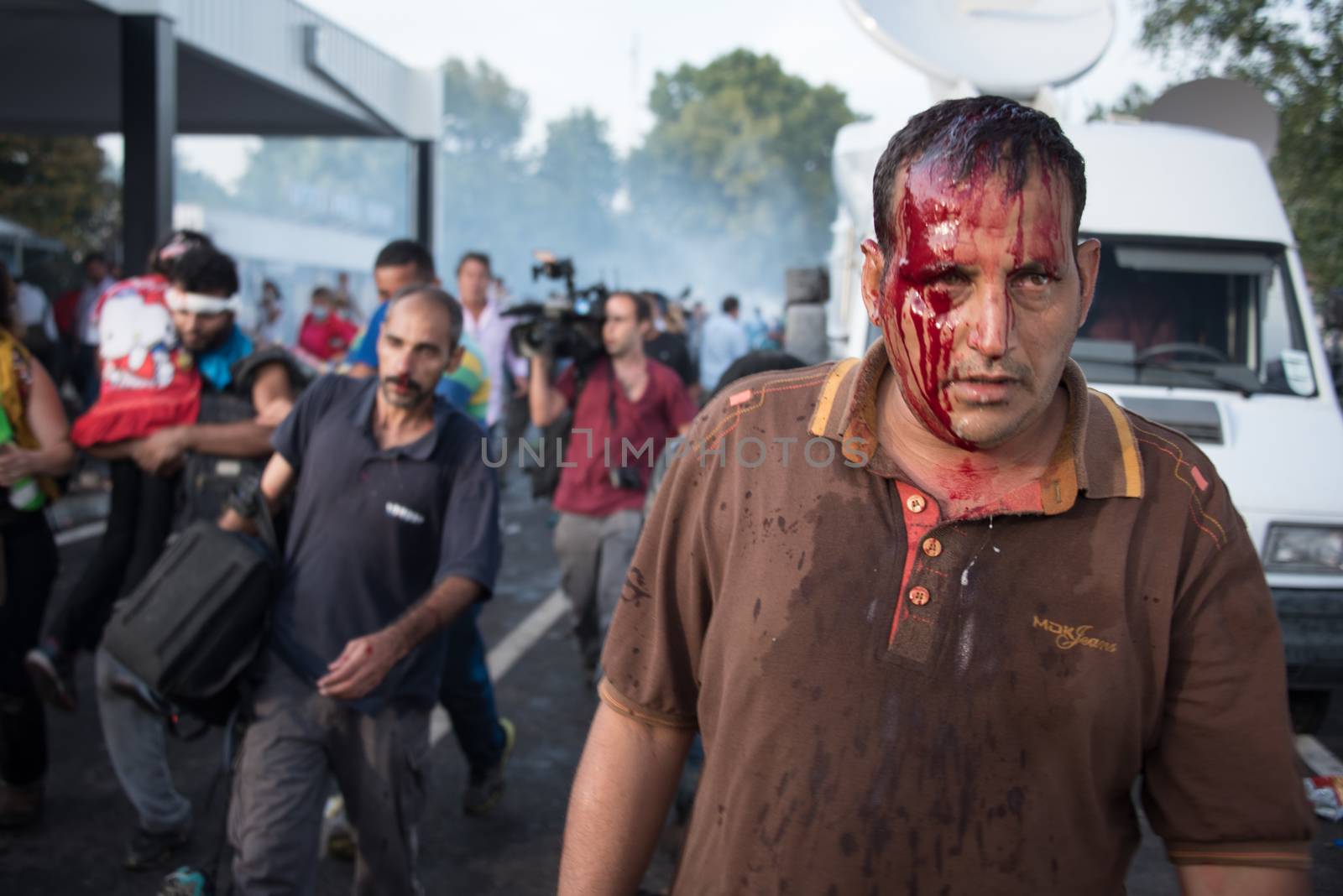 SERBIA, Horgos: Blood streams from a man's head as Hungarian riot police clash with refugees waiting to cross the border from the Serbian border town of Horgos on September 16, 2015. 