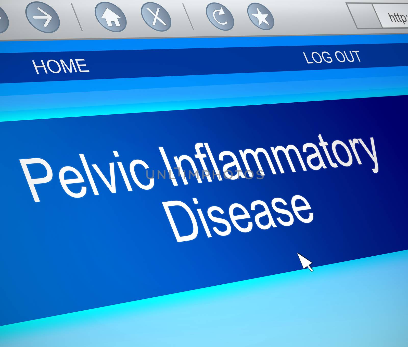 Illustration depicting a computer screen capture with a Pelvic inflammatory disease concept.