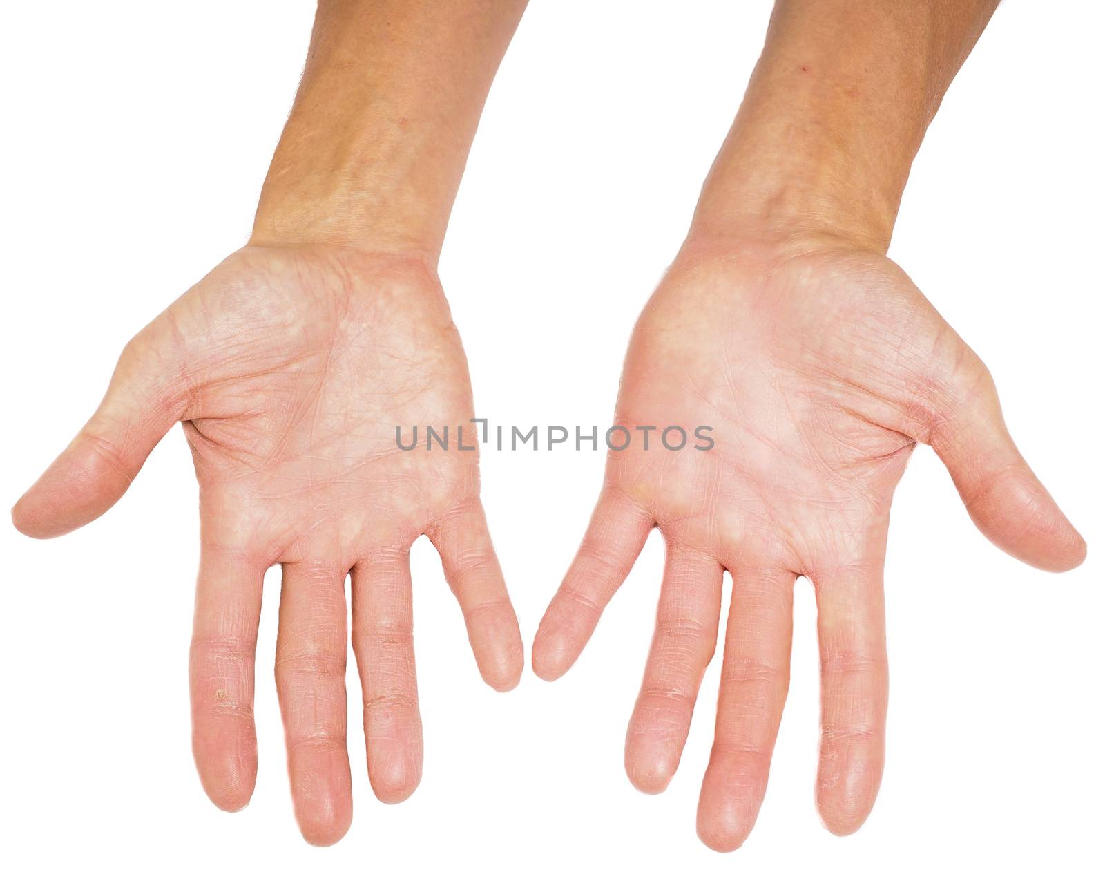 Hands of a male person with fingers spread isolated towards whit by Arvebettum