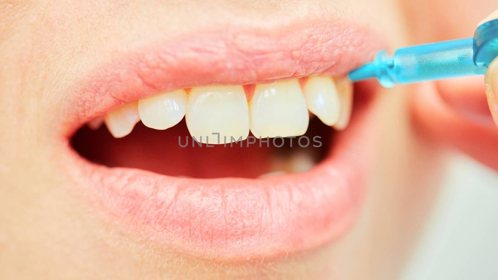 dentist brushing teeth to her patient in dental clinic