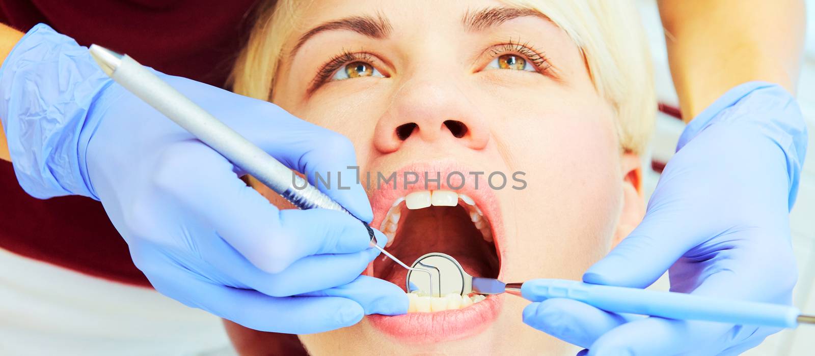 Close-up of a pretty patient with her mouth open in dental clinic
