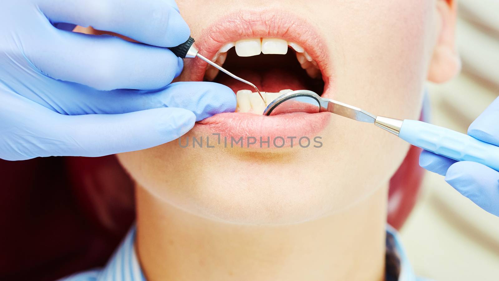 Close-up of a pretty patient with her mouth open in dental clinic