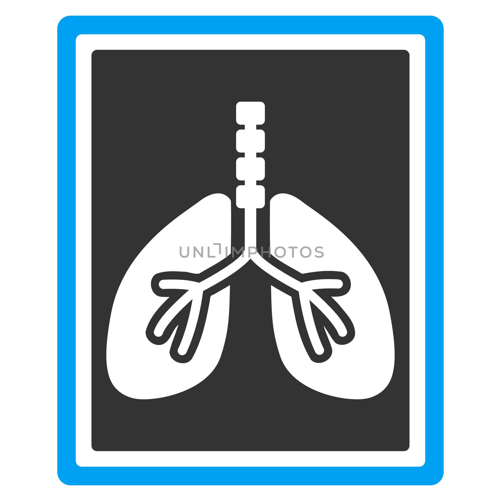 Lungs X-Ray Photo raster icon. Style is bicolor flat symbol, blue and gray colors, rounded angles, white background.