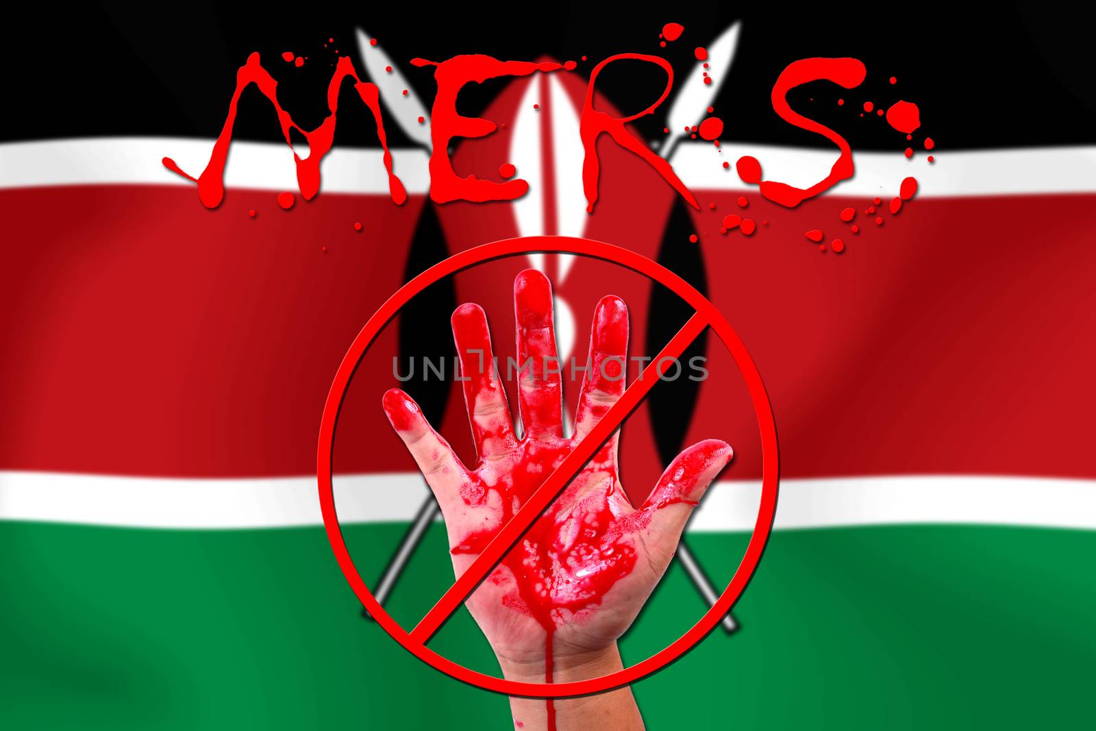 Concept show hand stop MERS Virus epidemic  KENYA flag background.