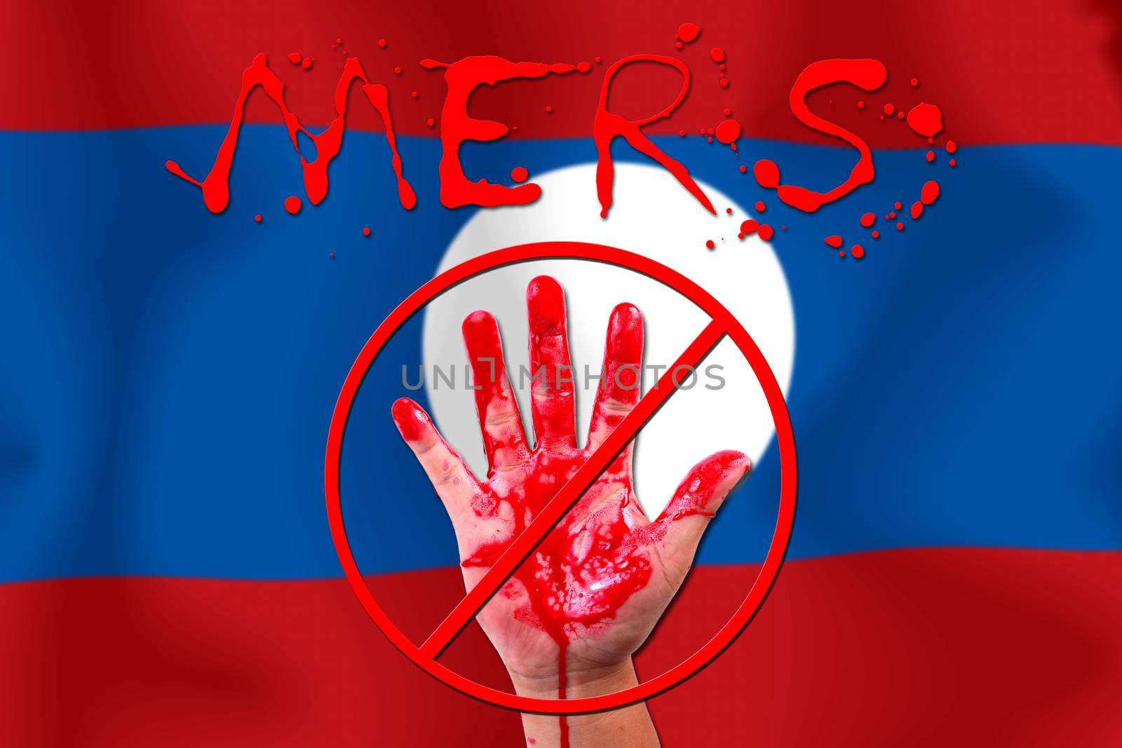 Concept show hand stop MERS Virus epidemic  Laos flag background.