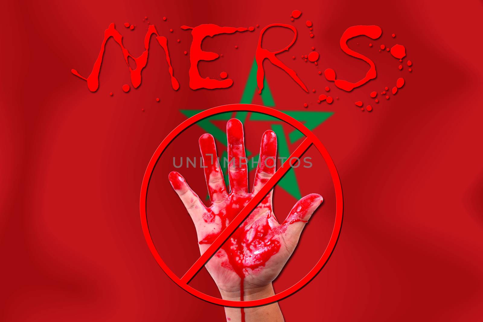 Concept show hand stop MERS Virus epidemic  Morocco flag background.