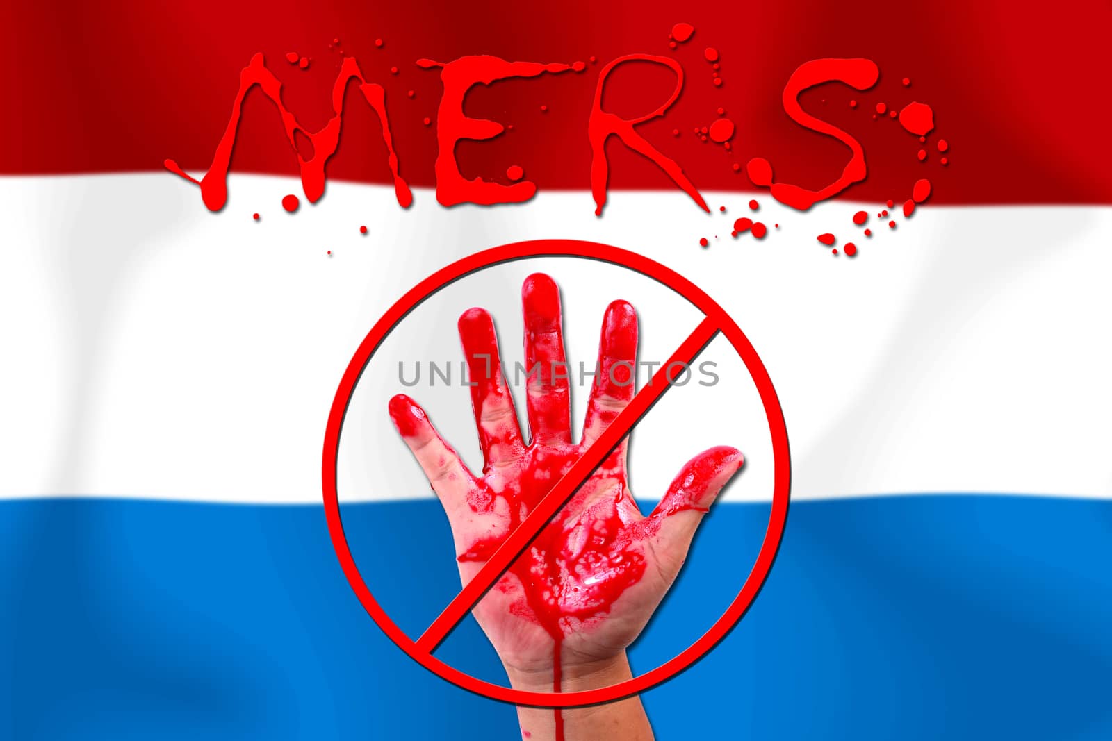 Concept show hand stop MERS Virus epidemic  Netherlands flag background.