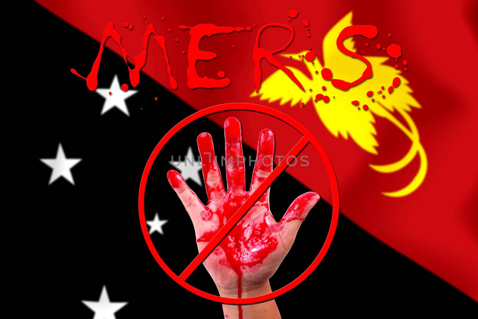 Concept show hand stop MERS Virus epidemic  PAPUA NEW GUINEA flag background.