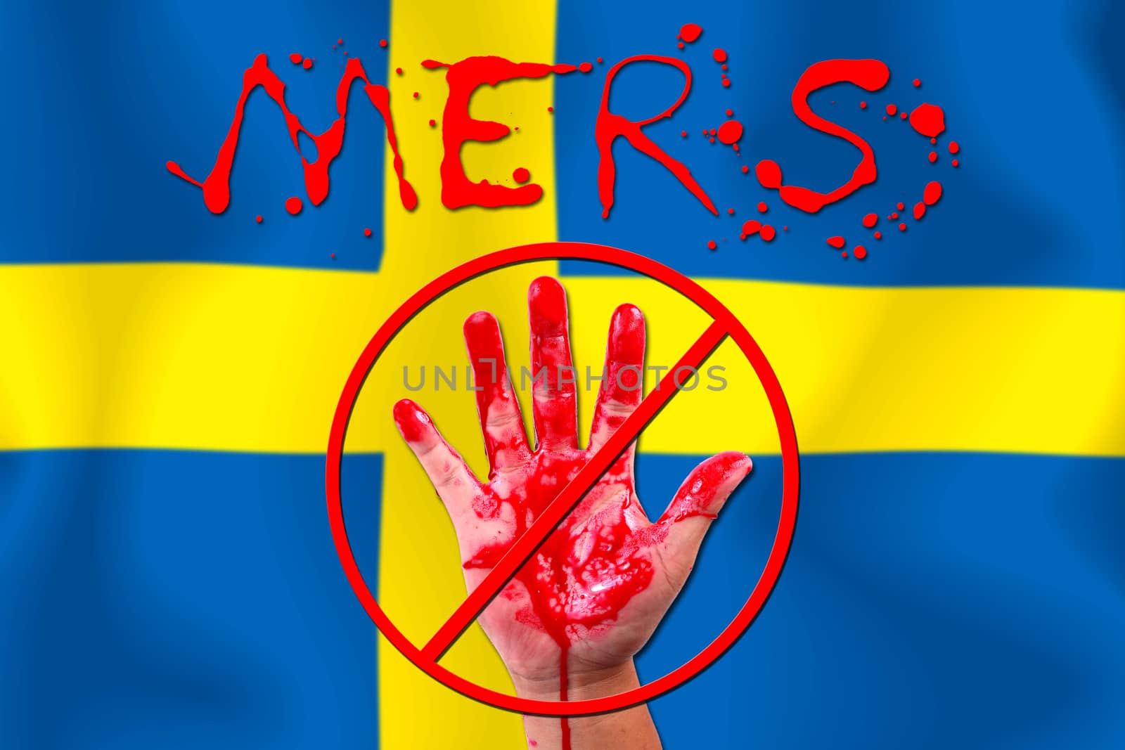 Concept show hand stop MERS Virus epidemic  Sweden flag background.