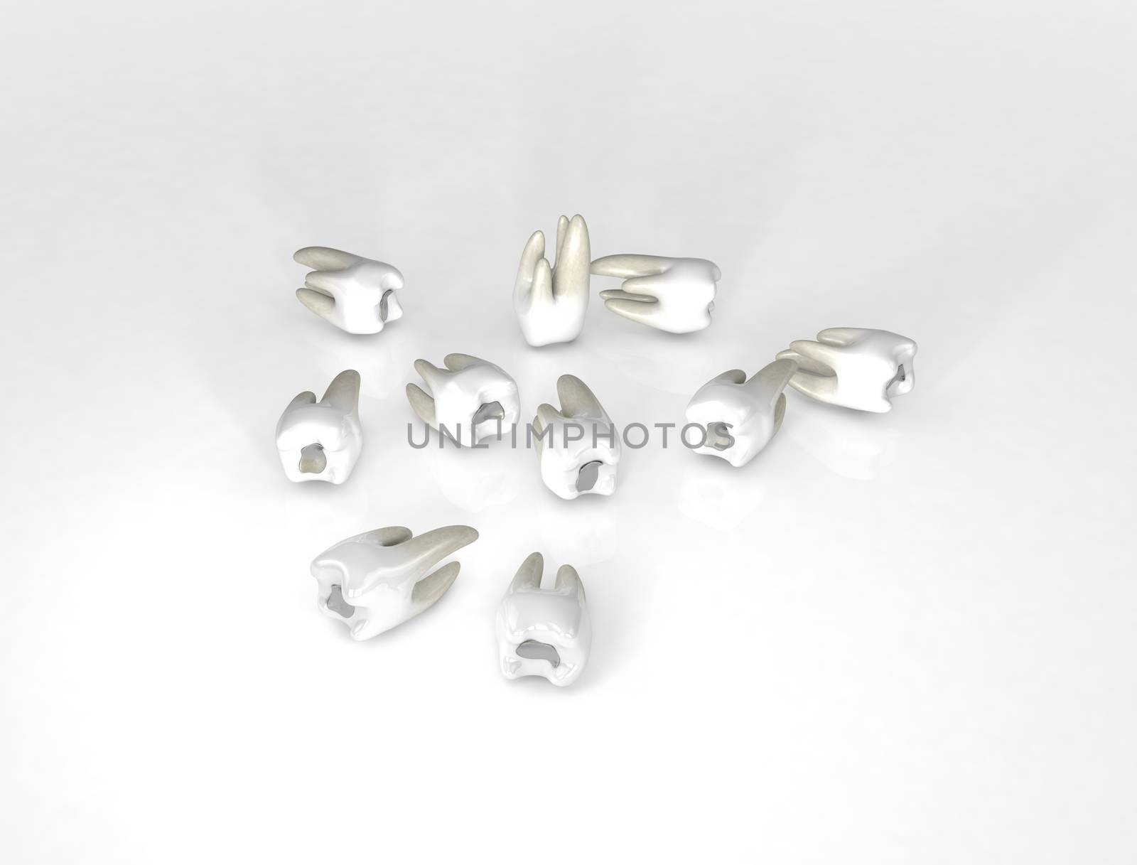 A 3D render of nine teeth with fillings spread on white surface