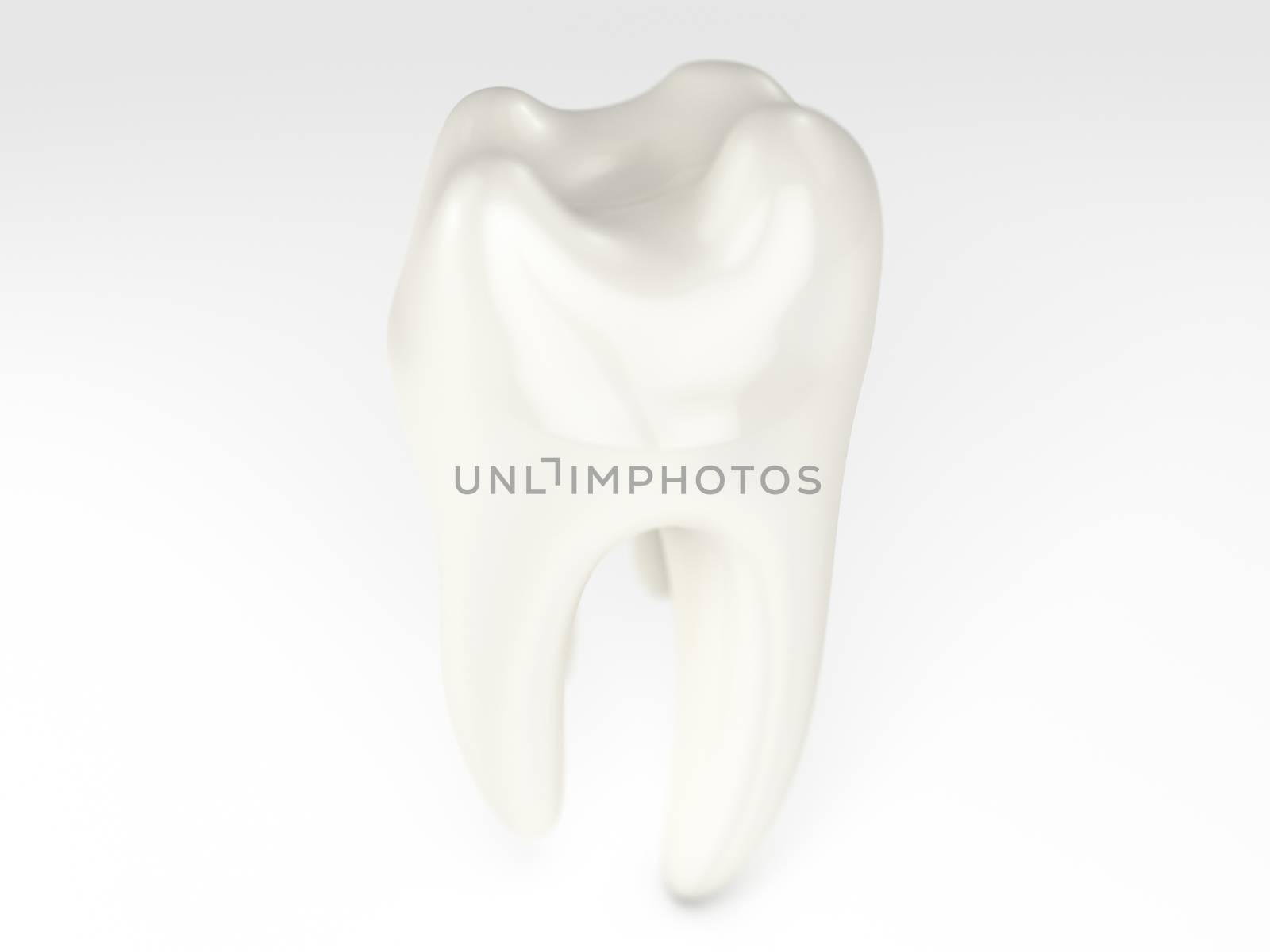 A 3D rendering of an off colour tooth on a white background