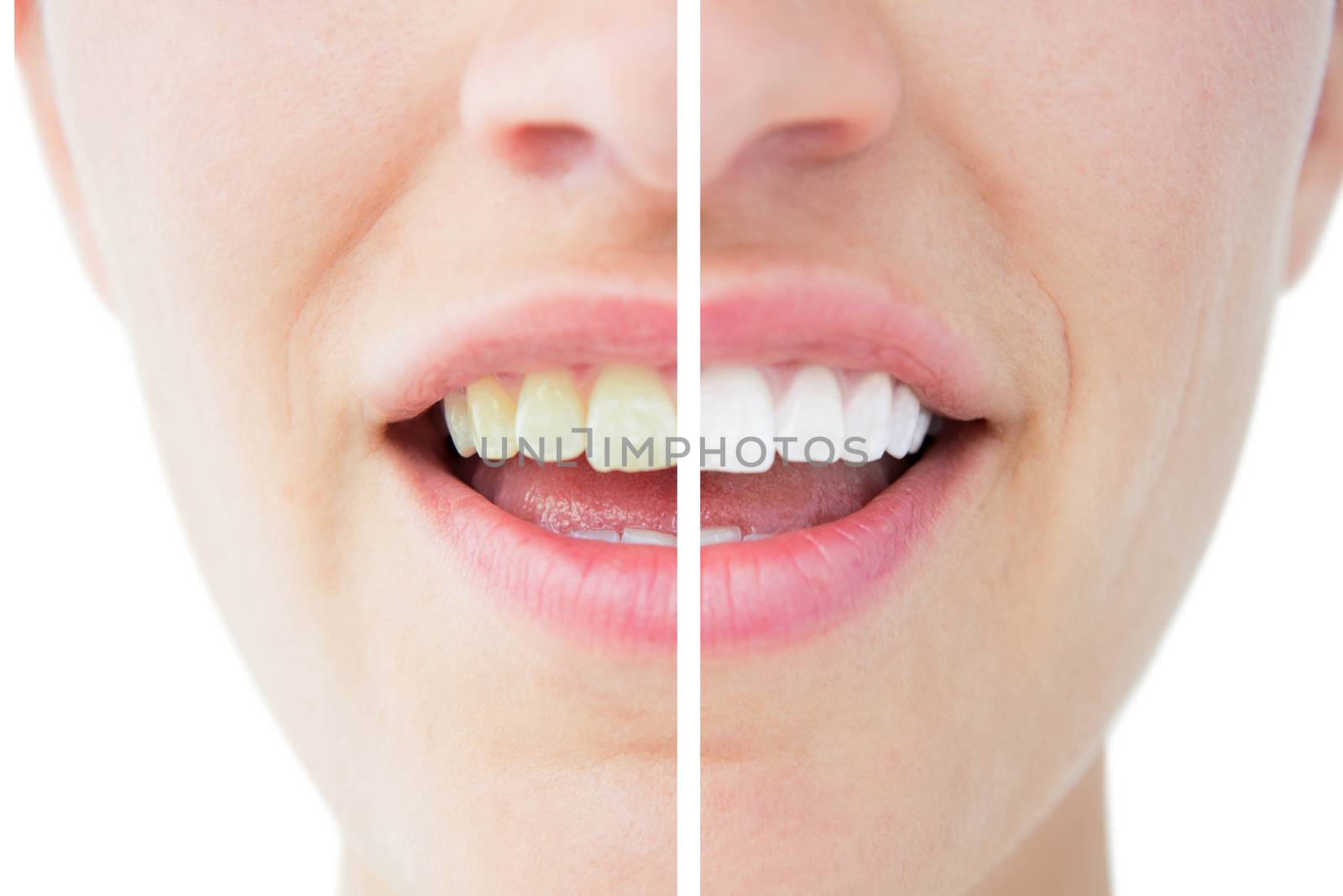 Pretty woman showing her teeth  by Wavebreakmedia