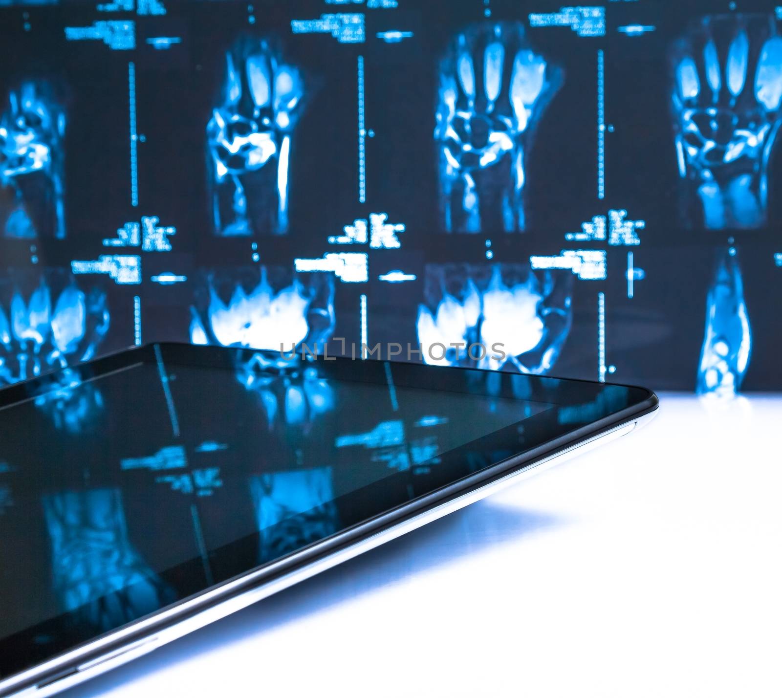 modern digital tablet pc in laboratory on x-ray images background by donfiore