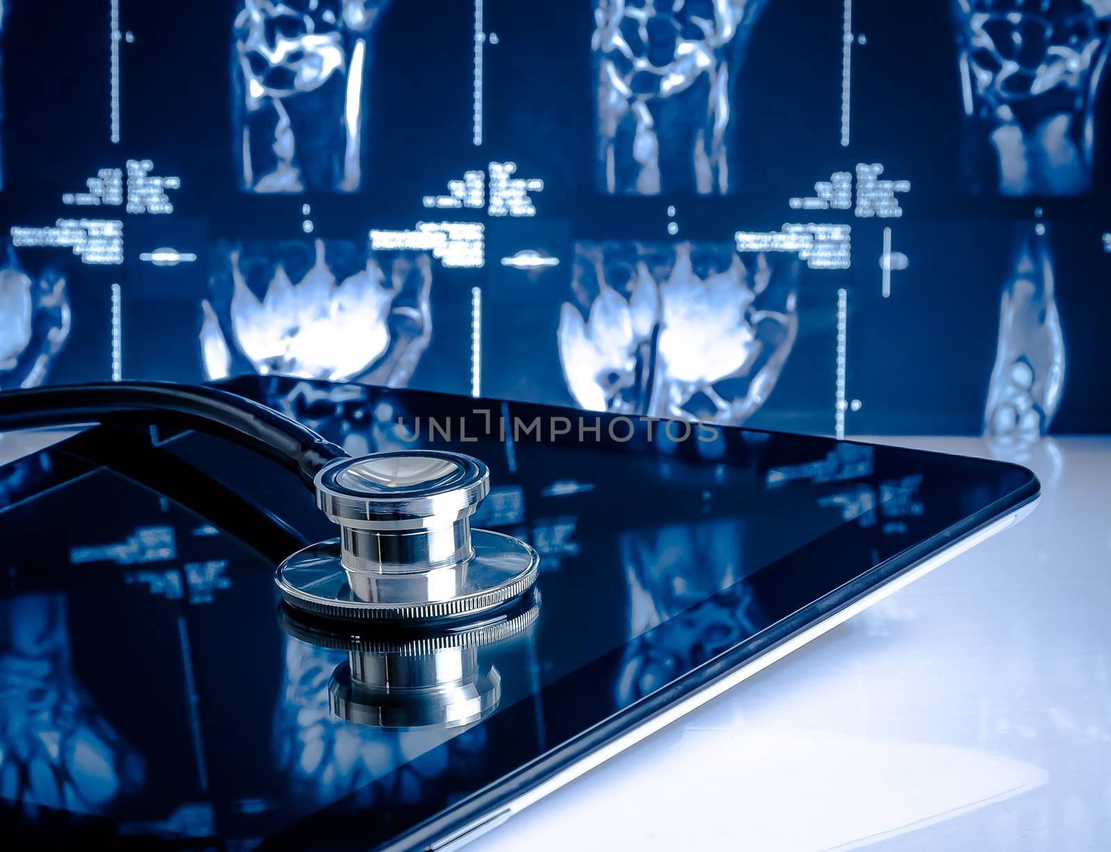 medical stethoscope on modern digital tablet in laboratory on x-ray images background by donfiore