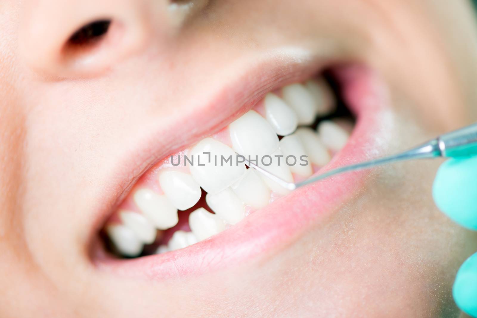 Close-up of Dentist examination and cleaning patient teeth with metal dental pick tool.