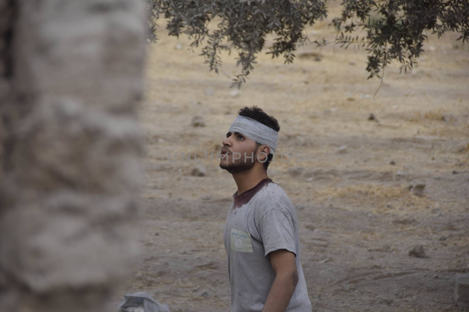 SYRIA, Harasta: This picture shows an injured man in the the Syrian town of Harasta on October 23, 2015 following a series of recent airstrikes. The Syrian army launched an offensive in the area which targeted various rebel opposition. In addition to airstrikes, the Syrian army also launched a ground operation in the region.