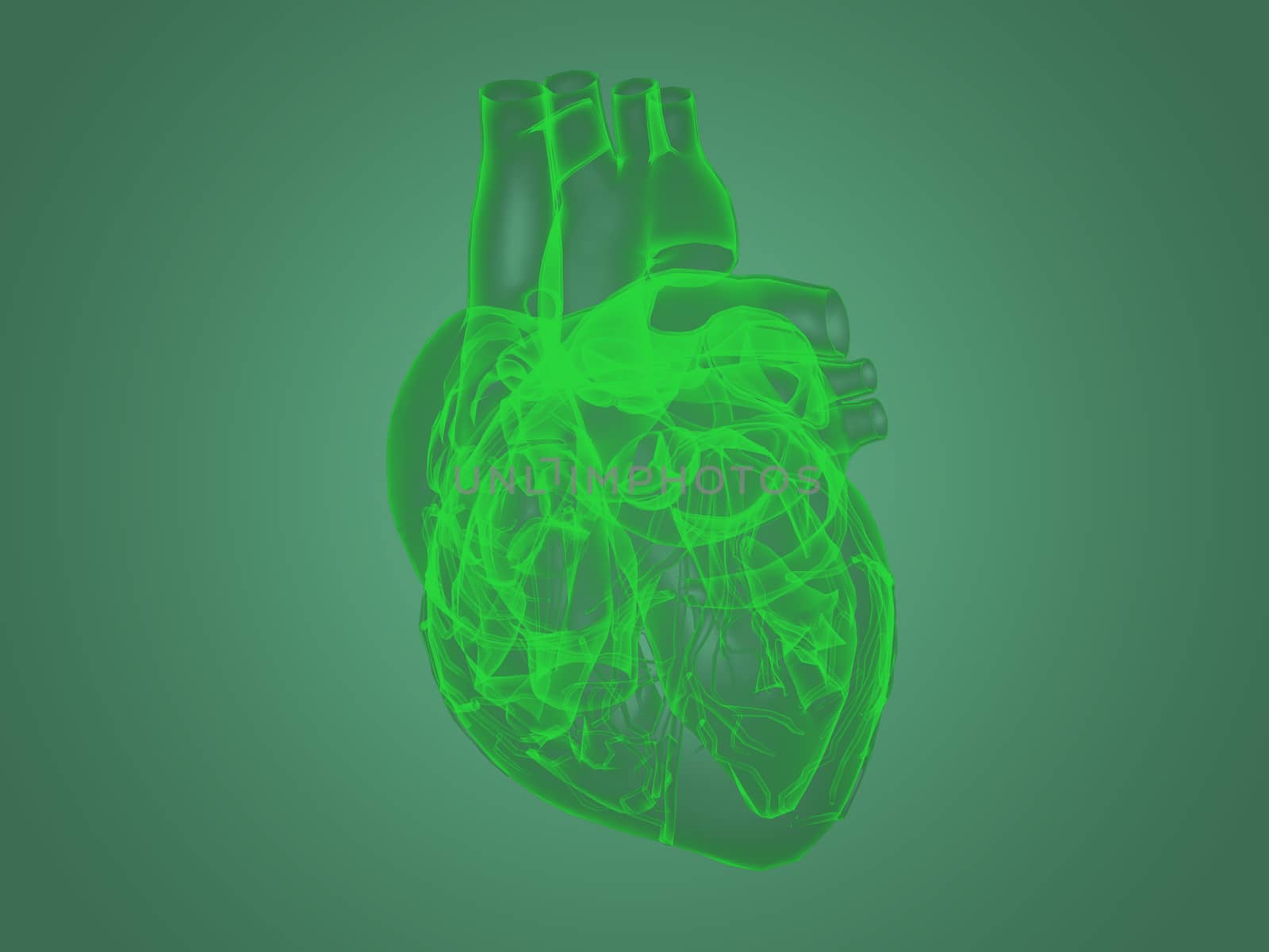 X-ray heart anatomy by teerawit