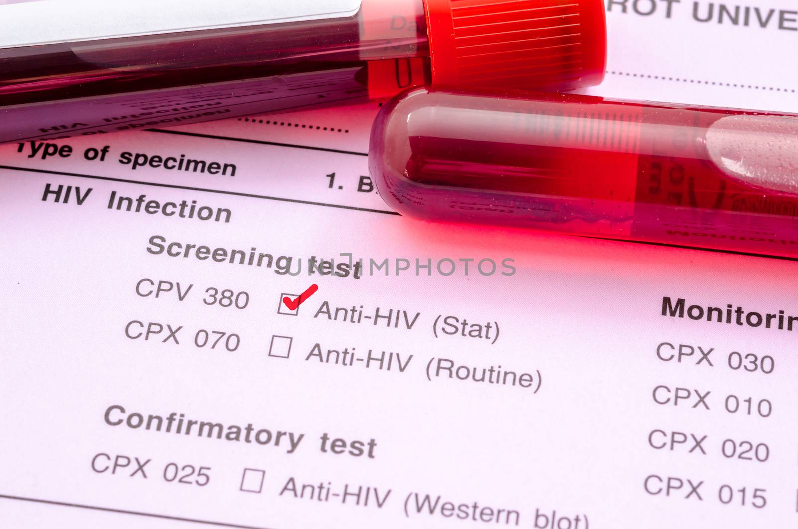 Sample blood collection tube with HIV test label on HIV infection screening test form.