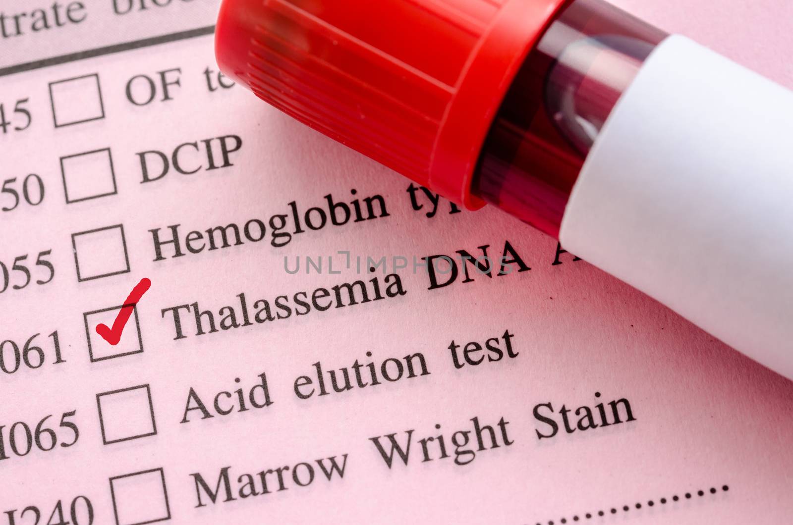 Sample blood in blood tube for Thalassemia DNA test on request form in laboratory.
