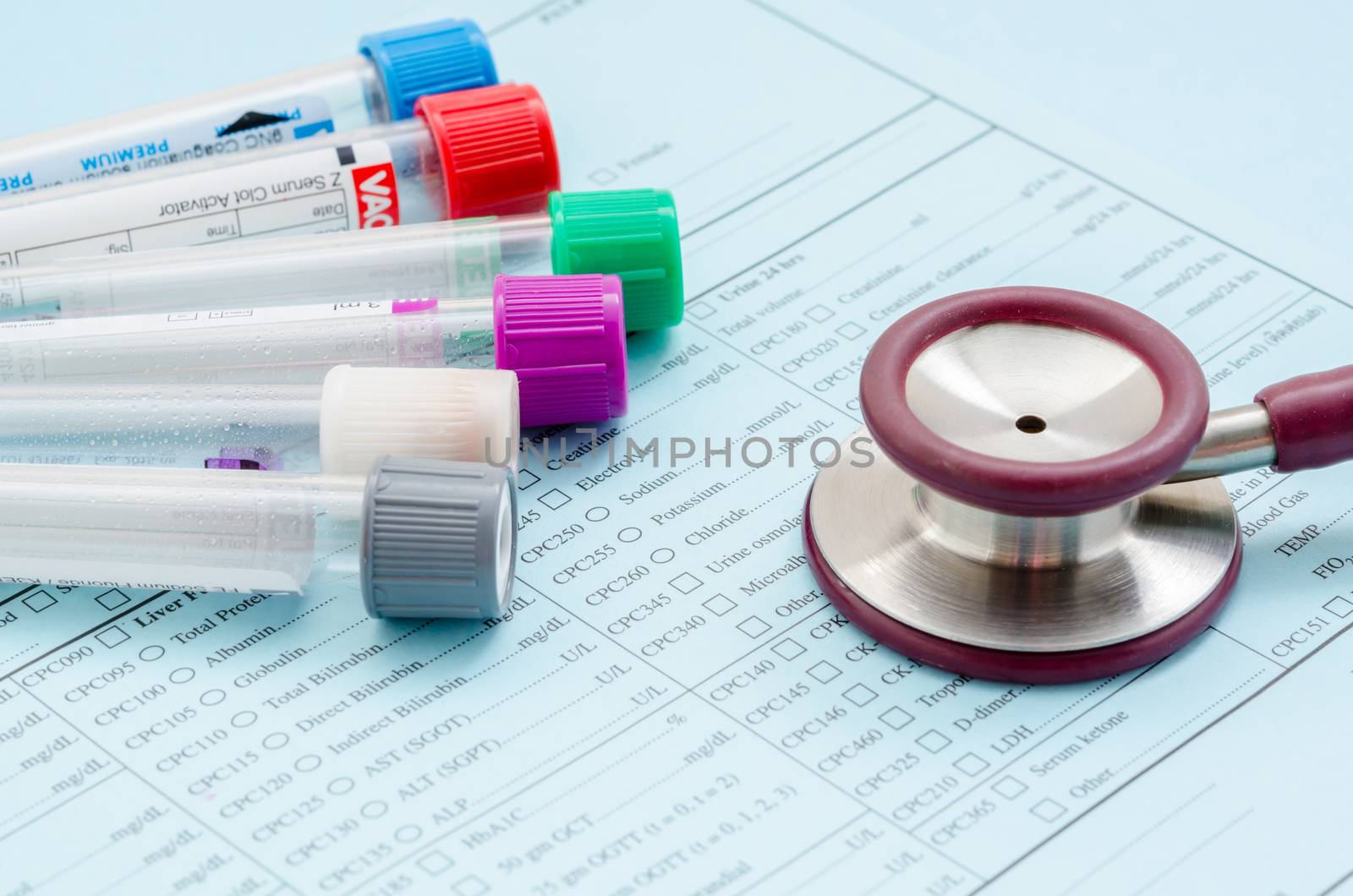 Stethoscope tube of blood and medical check list in laboratory.