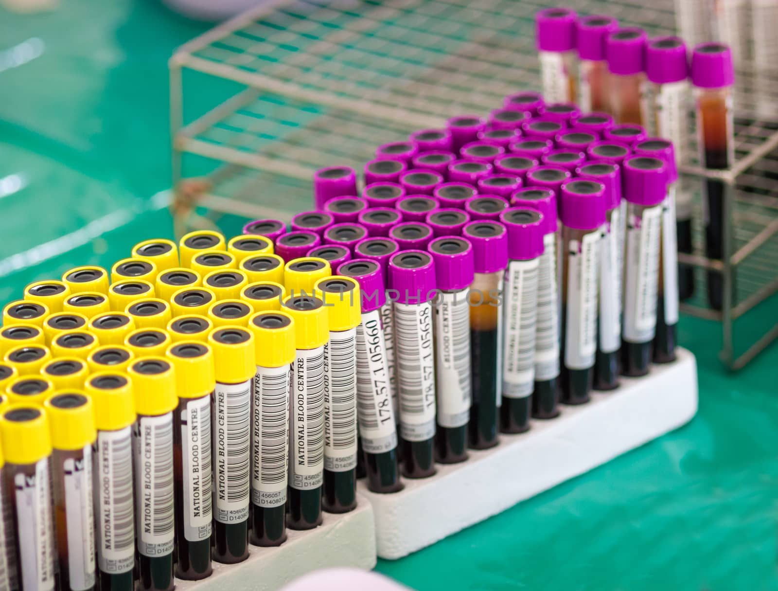 arranges test tubes with blood on a tray