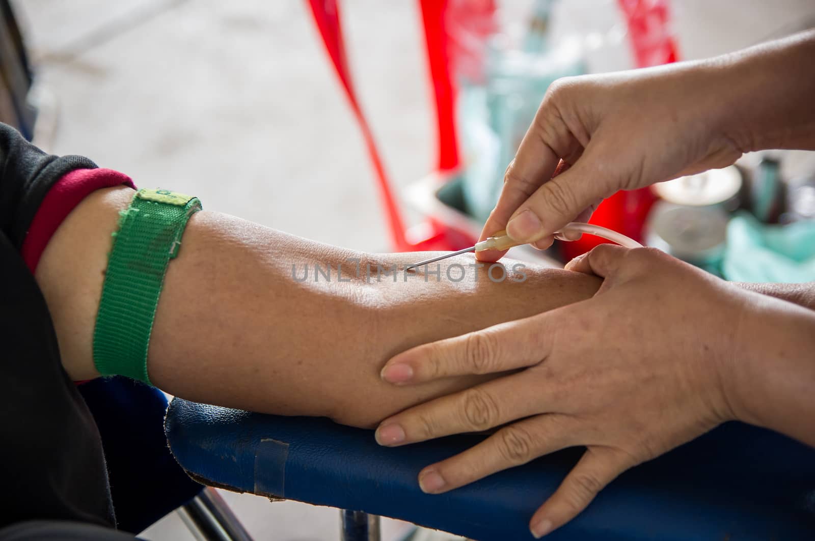 Closeup of blood donor at donation.