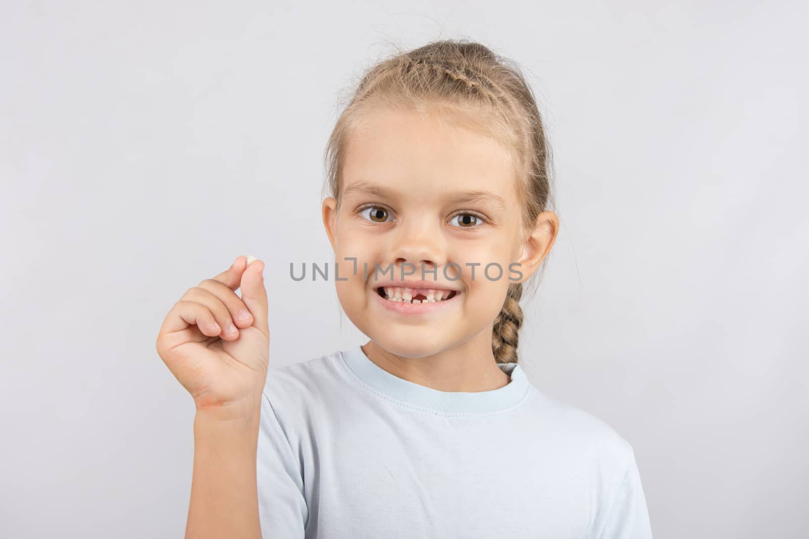 Six year old girl showing her fallen Milk front upper teeth