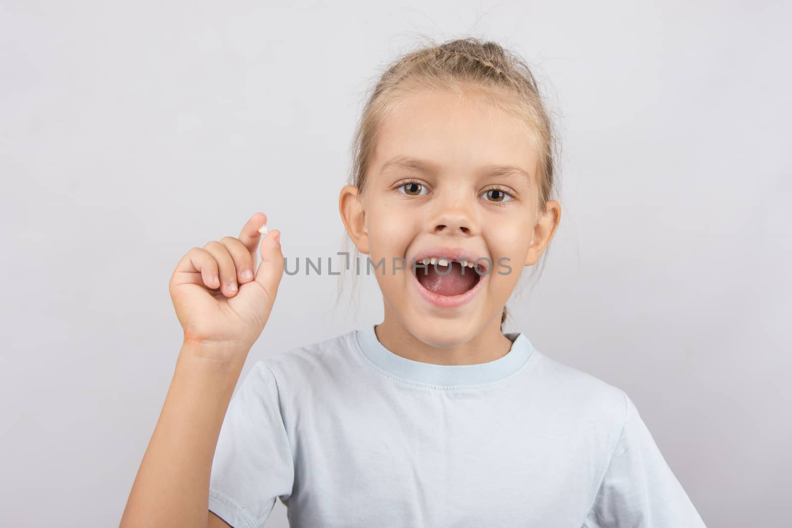Six year old girl showing her fallen Milk front upper teeth