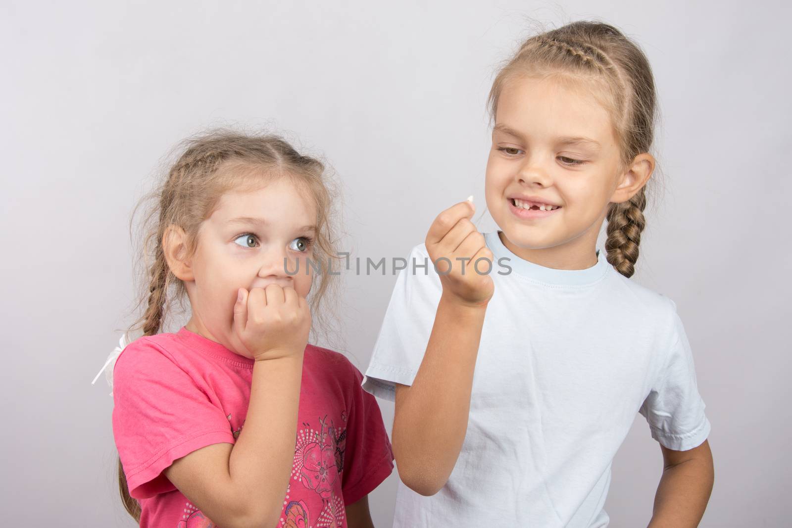 Six year old girl showing her the other girl had fallen Milk front upper teeth