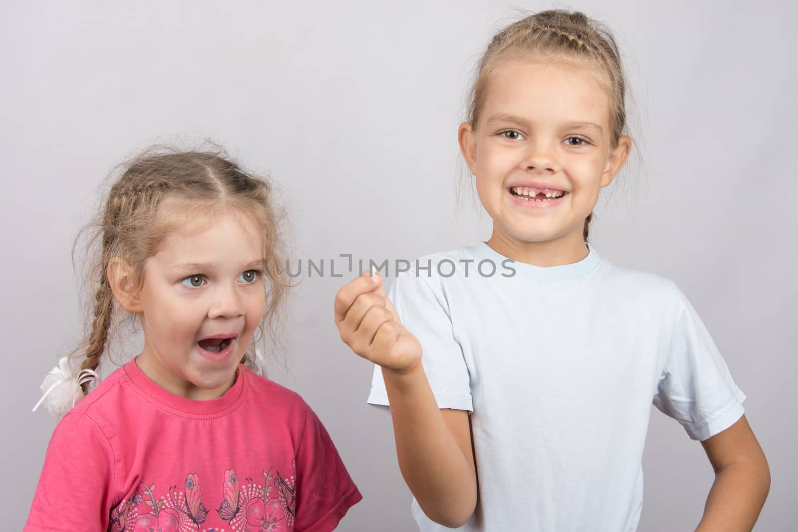 Six year old girl showing her the other girl had fallen Milk front upper teeth