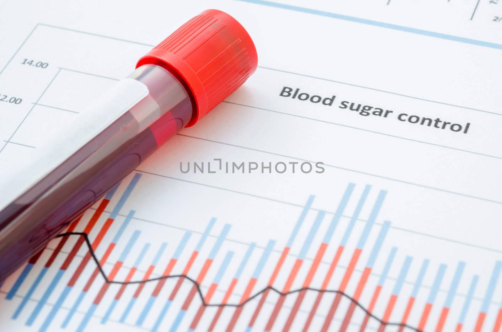 Sample blood for screening diabetic test. by Gamjai