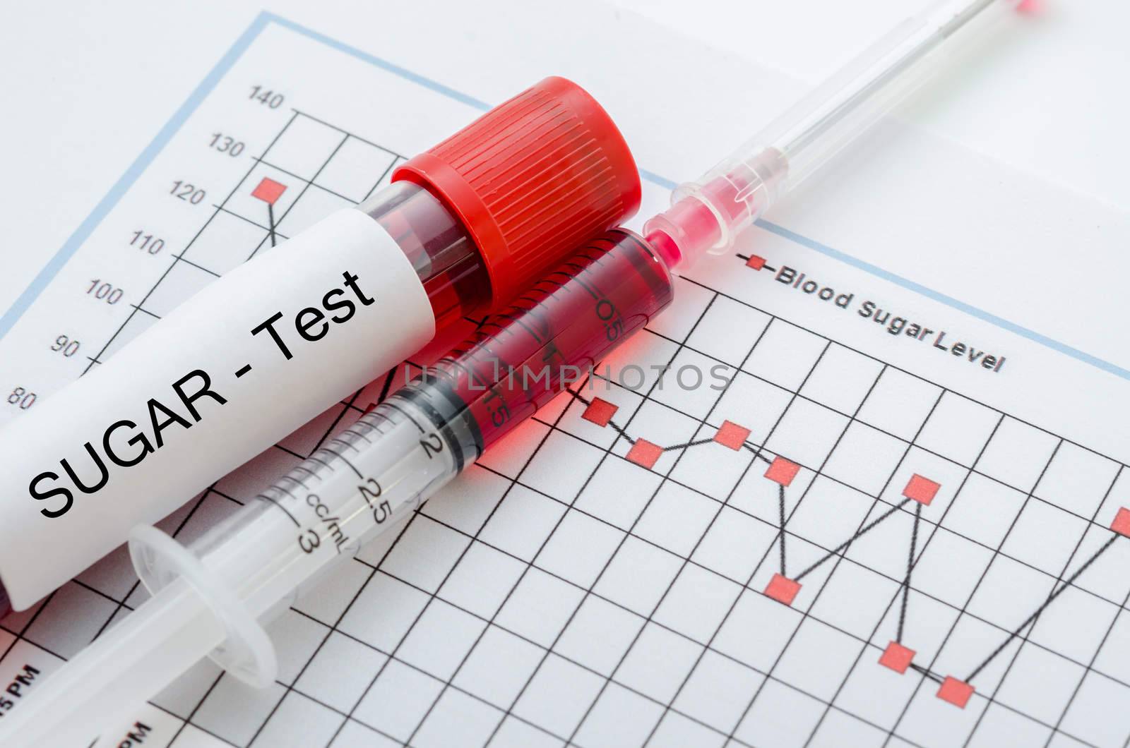Sample blood for screening diabetic test. by Gamjai
