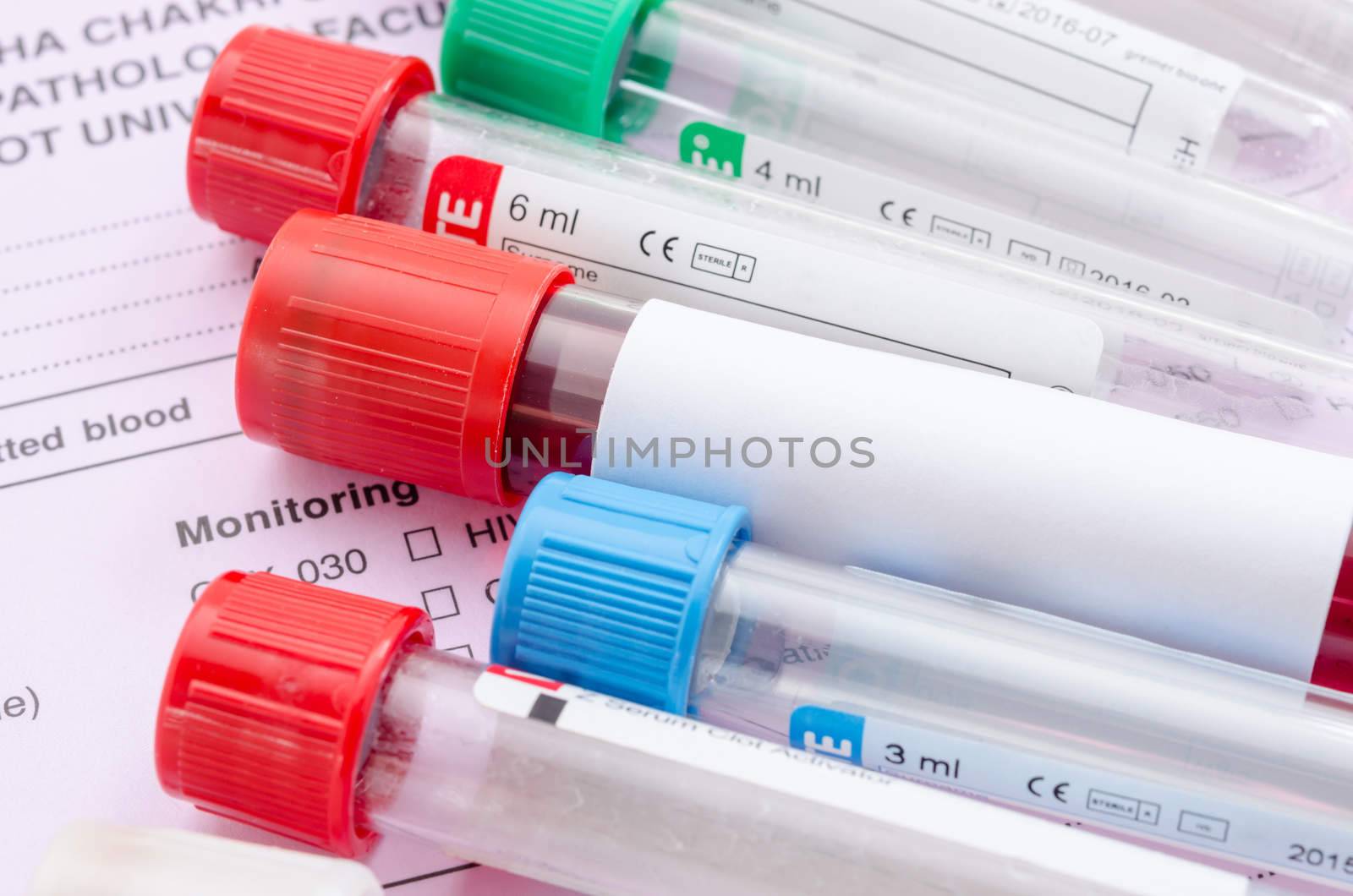 Blood sample test and empty tube blood for blood test screening on form screening background.