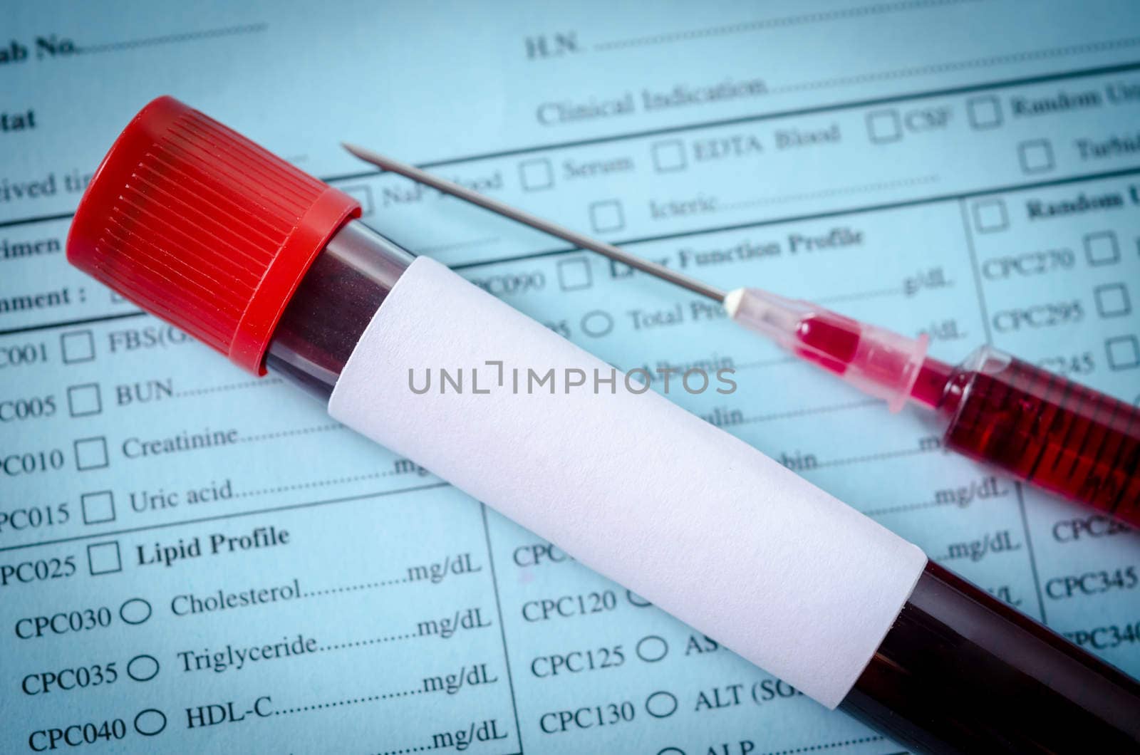 Blood tube for test and blood in syringe. by Gamjai