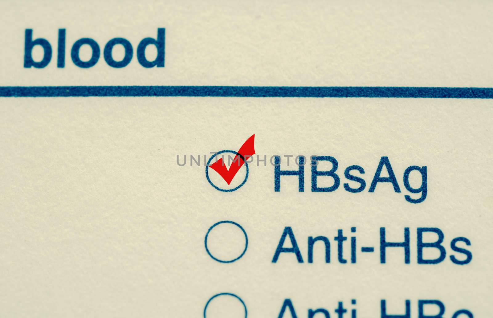 Close up check mark Hepatitis B virus test form.