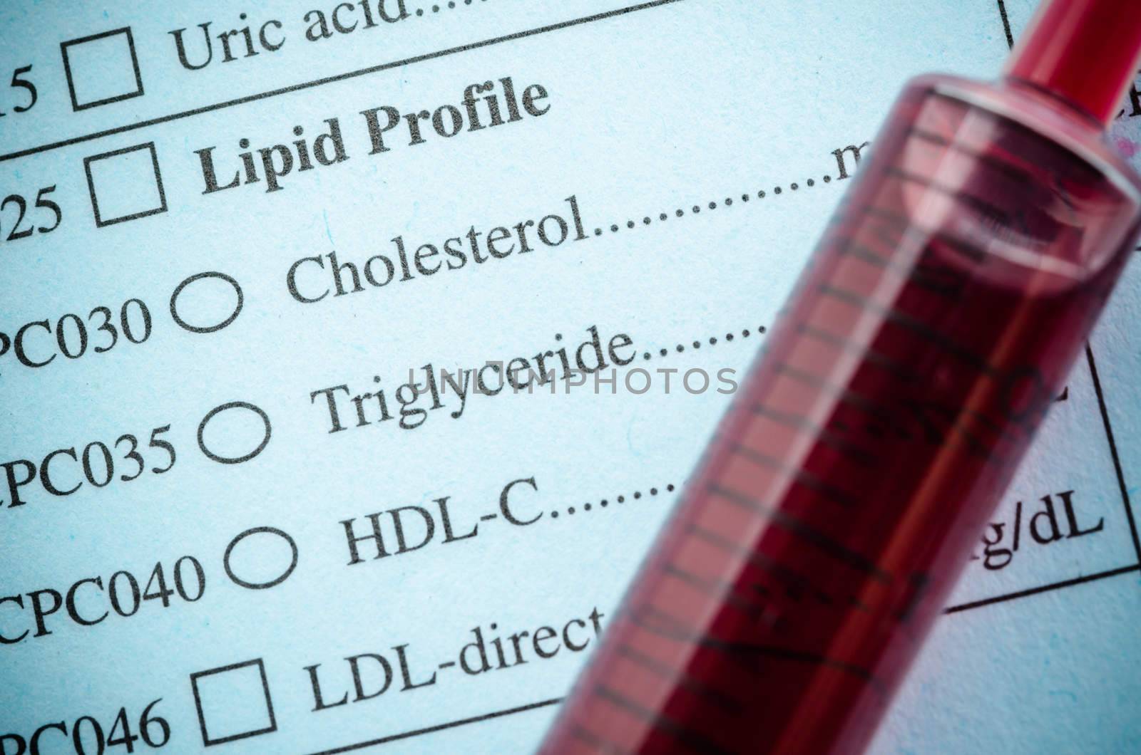 Medical check list Cholesterol, triglyceride and blood in synring. In the laboratory.
