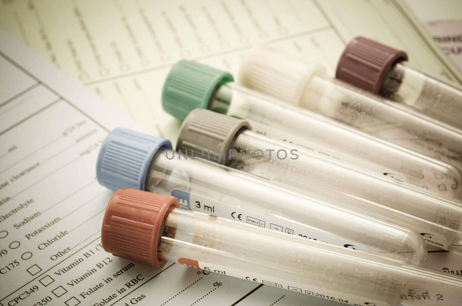 The old blood tubes for test on reqest form medical testing in Laboratory.