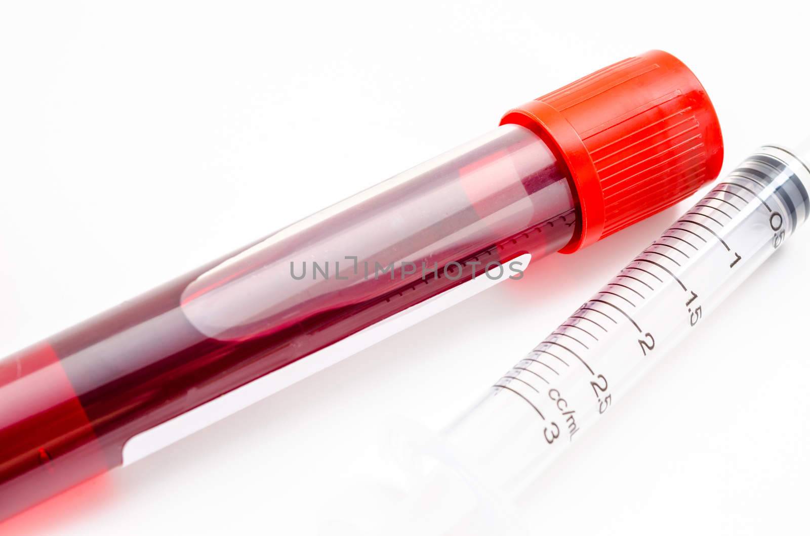 Blood sample in tube blood for screening test and syringe on white background.