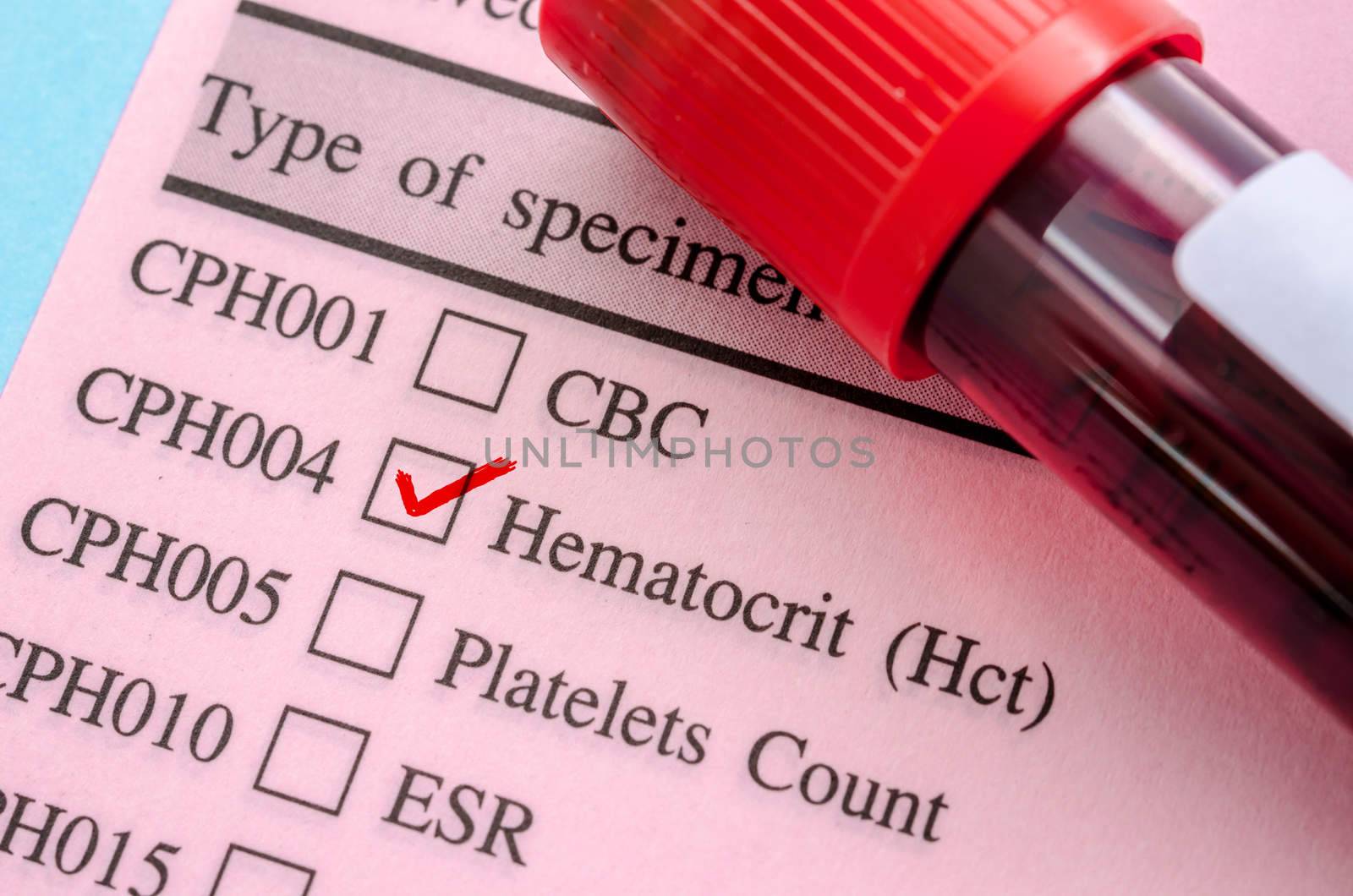 Blood vial with blood sample on test form screening Hematocrit (Hct)