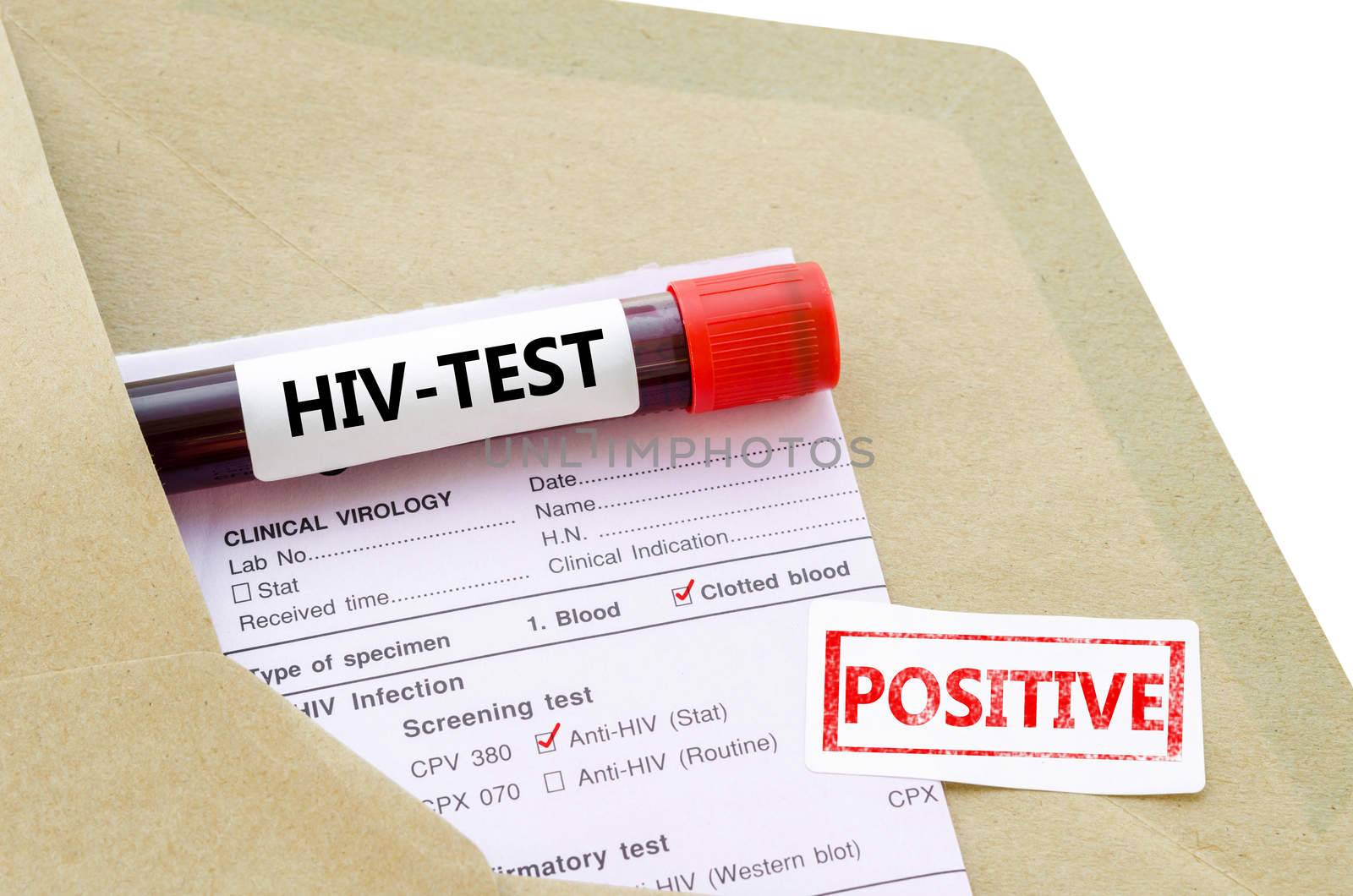 Blood sample with HIV test positive and request laboratory form on white background.