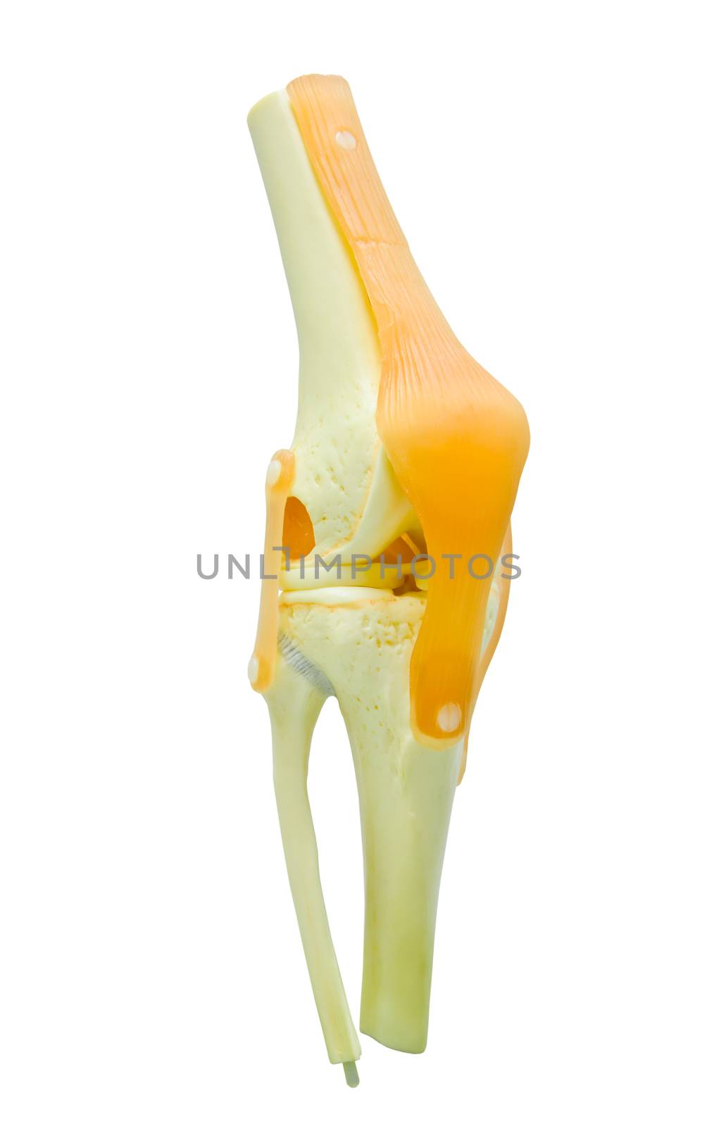 plastic study model of a knee replacement. by Gamjai