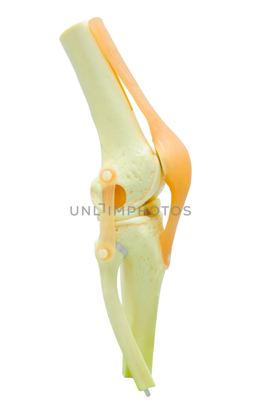 plastic study model of a knee replacement. clipping path.