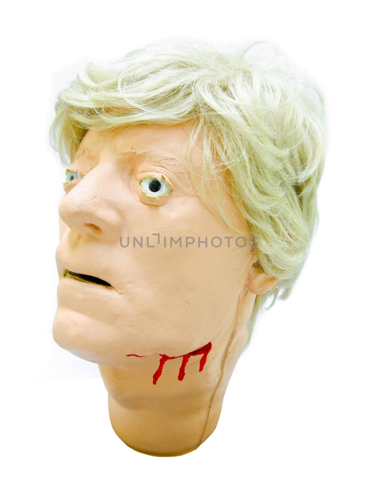 Head injury patients model. by Gamjai