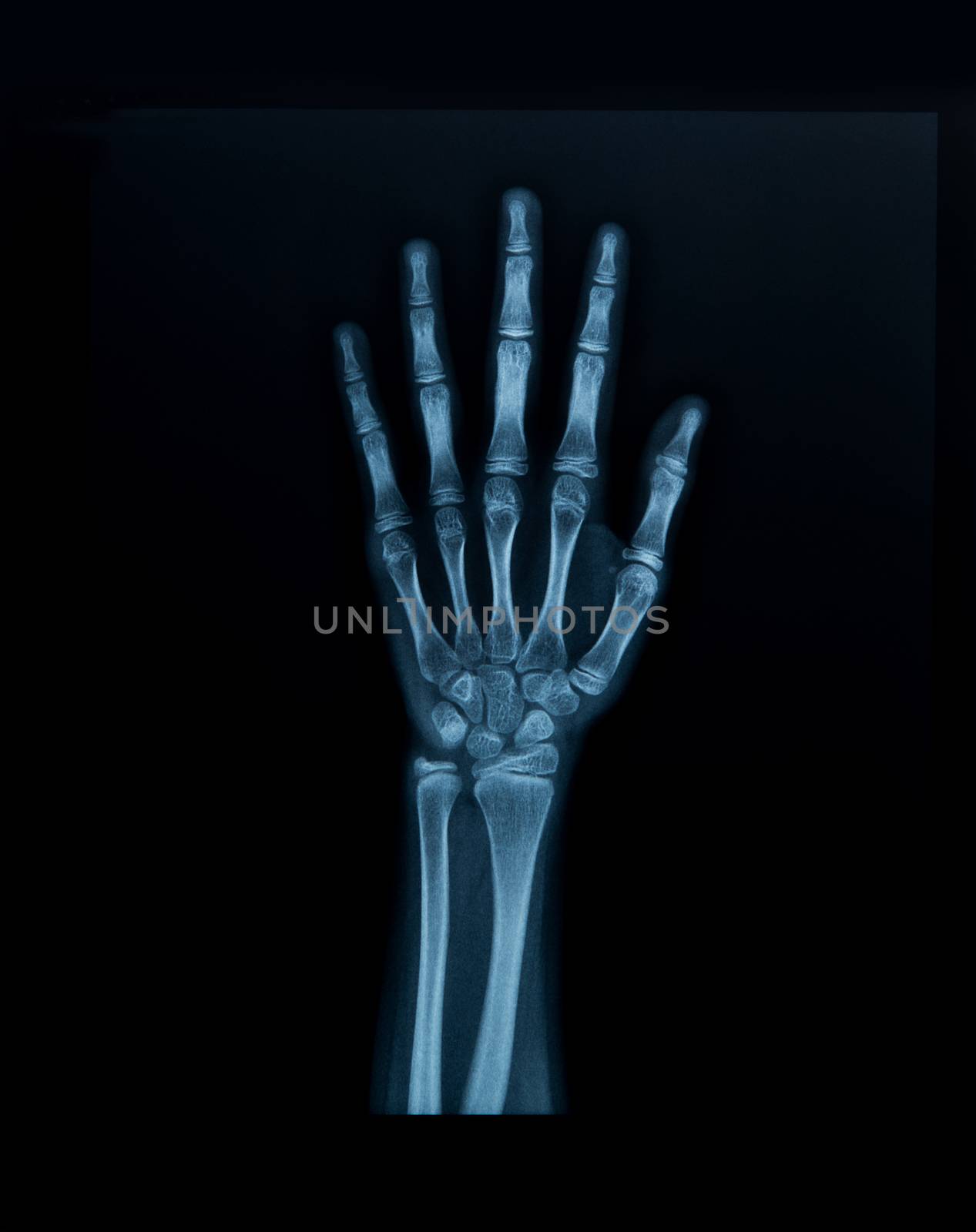 x-ray hand by antpkr