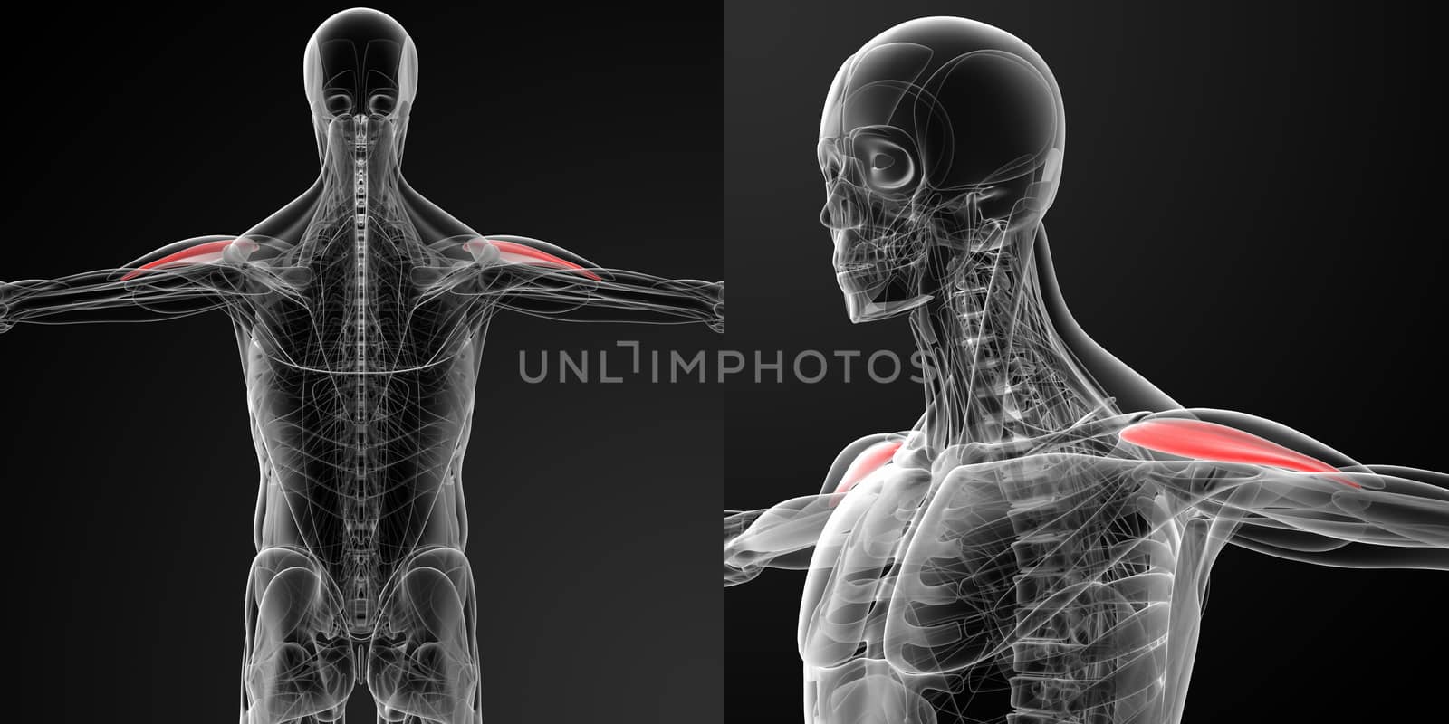 medical illustration of the Anterior Deltoid