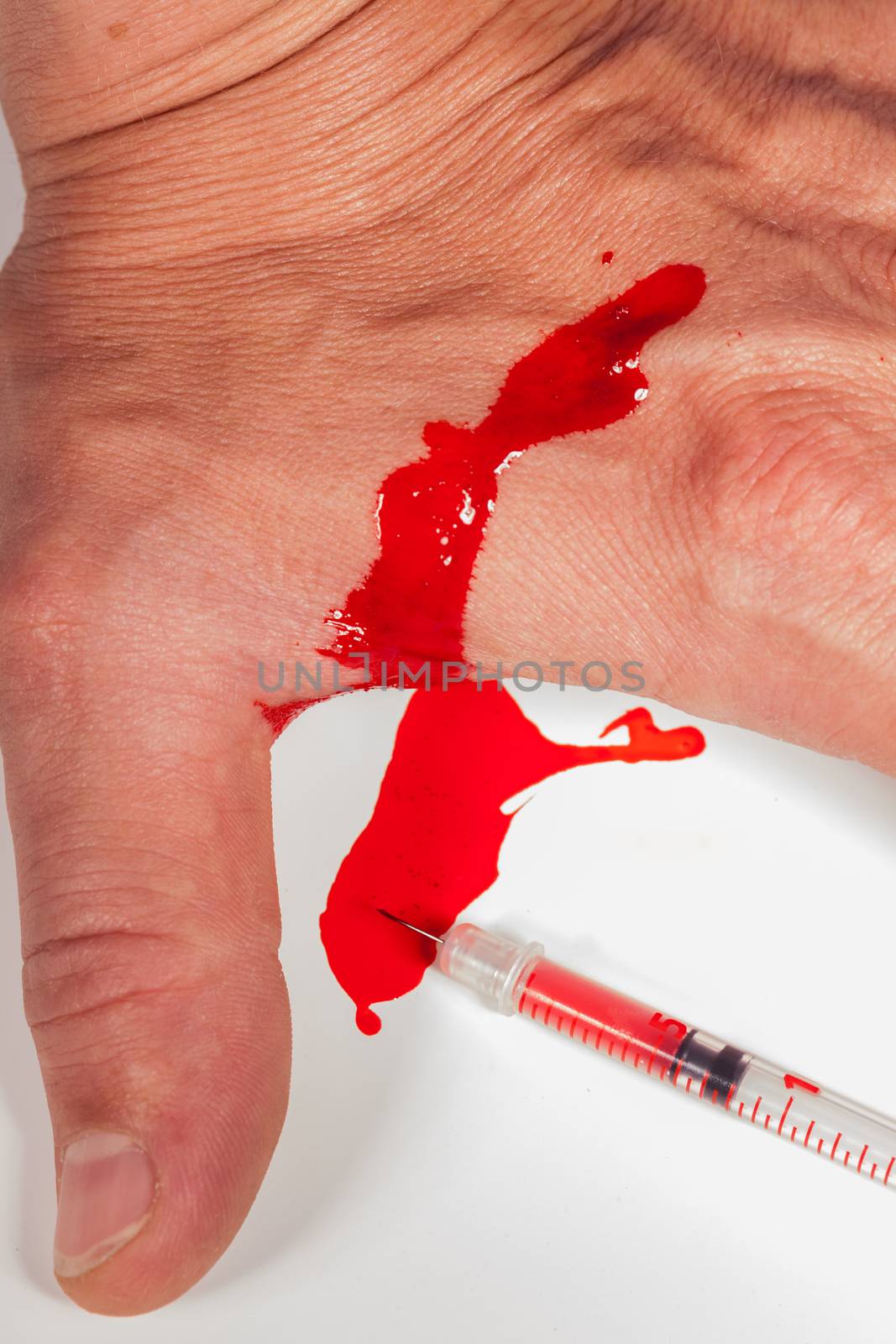 Subcutaneous medical injection concept with a small hypodermic syringe filled with a red liquid penetrating the skin and producing a flow of dripping blood in a close up view